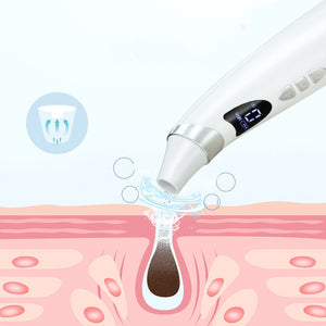 Electric Visual Blackhead Suction – Household Pore Cleaner Tool