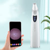 Electric Visual Blackhead Suction – Household Pore Cleaner Tool