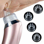 Electric Blackhead Vacuum – Pore Cleaner & Acne Remover Tool