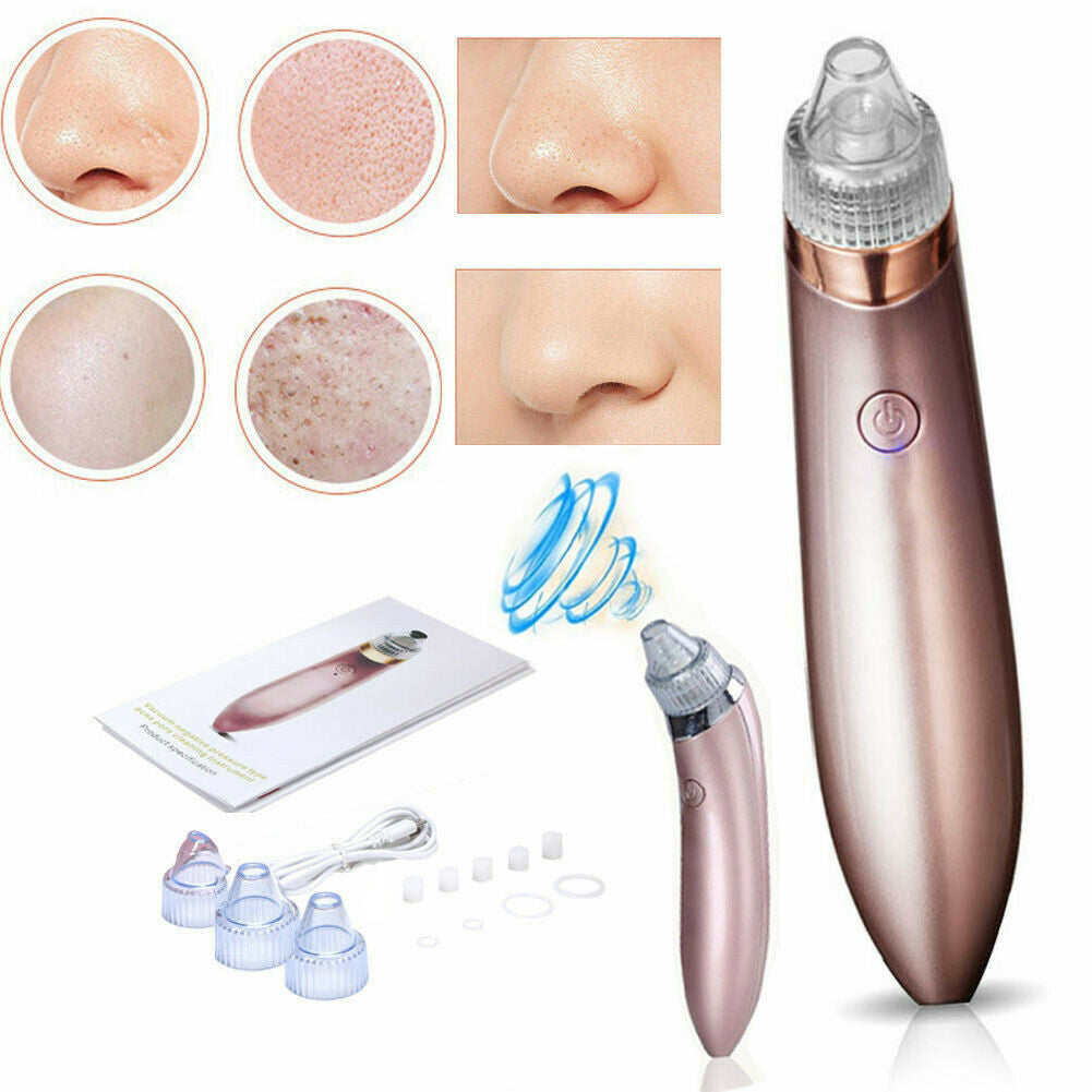 Electric Blackhead Vacuum – Pore Cleaner & Acne Remover Tool